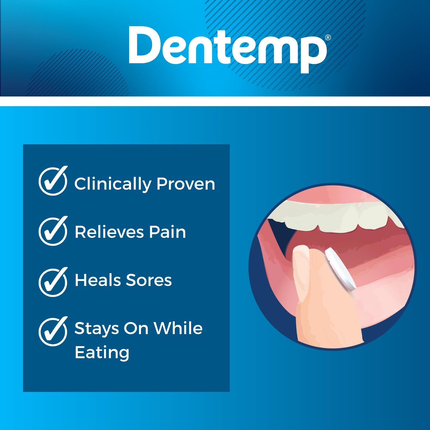 Dentemp Canker Cover – Canker Sore Pain Relief Tablets (6 Count)