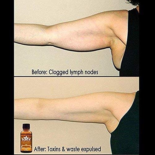 3-Pack Ginger Oil for Lymphatic Drainage – Promote Blood Circulation & Metabolism | SPA Massage Oil