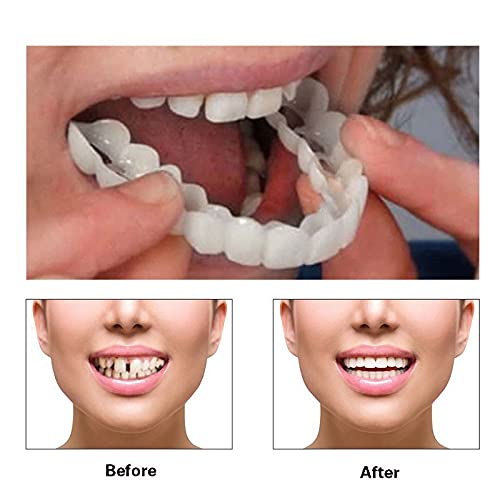 2 Pairs Temporarily Adjustable for Men and Women – Natural & Comfortable