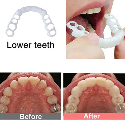 2 Pcs Temporary Adjustable Smile - Natural White, Comfortable for Men & Women