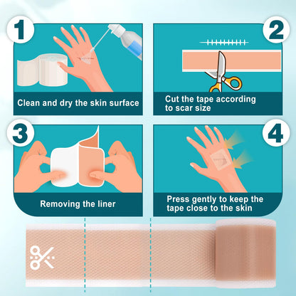 Arme Silicone Scar Tape – 4 Roll Pack (480") Reusable Medical-Grade Scar Sheets