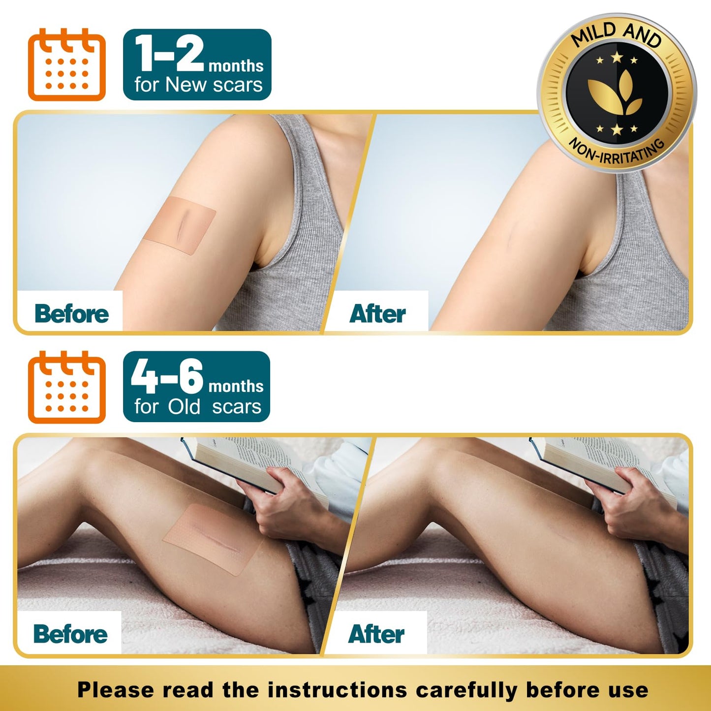 Arme Silicone Scar Tape – 1.6in x 240in Medical-Grade Scar Sheets (2 Rolls)