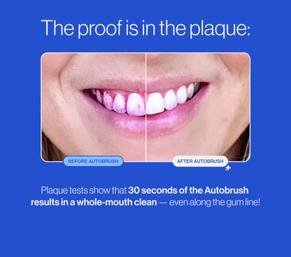 autobrush Kids Electric Toothbrush – ADA-Accepted U-Shaped, Clinically Proven 5.1x Cleaner, 30s Full-Mouth 360-Degree Coverage, LED Lights & Music (Ages 6-8, Dinosaur)
