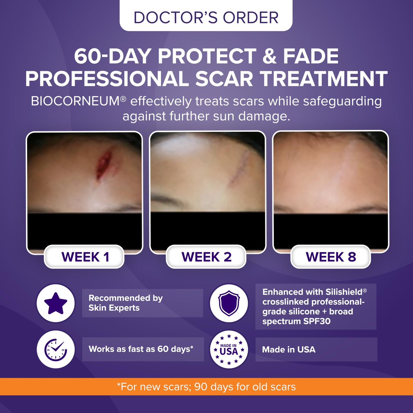 BIOCORNEUM Advanced Scar Treatment with Silishield SPF 30 (50g) – Surgeon-Recommended Silicone Scar Gel