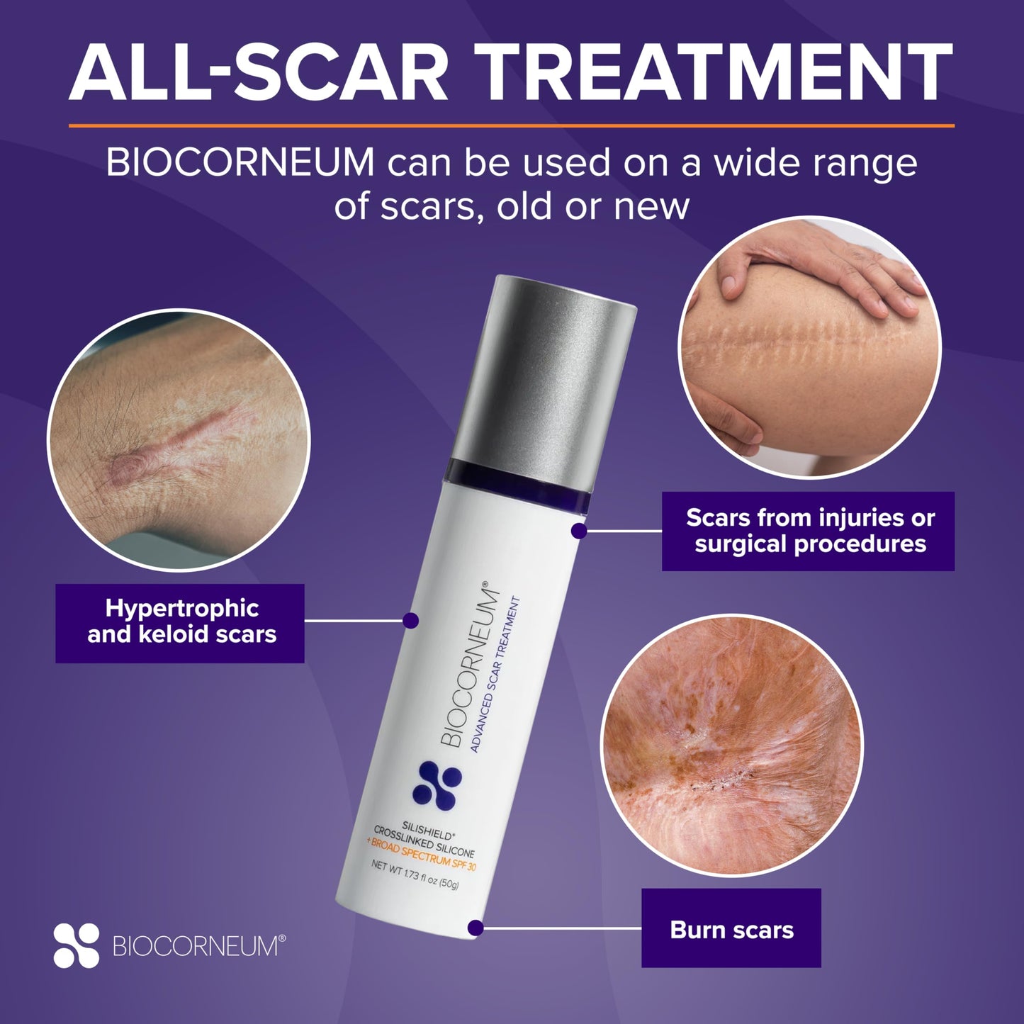 BIOCORNEUM Advanced Scar Treatment with Silishield SPF 30 (50g) – Surgeon-Recommended Silicone Scar Gel