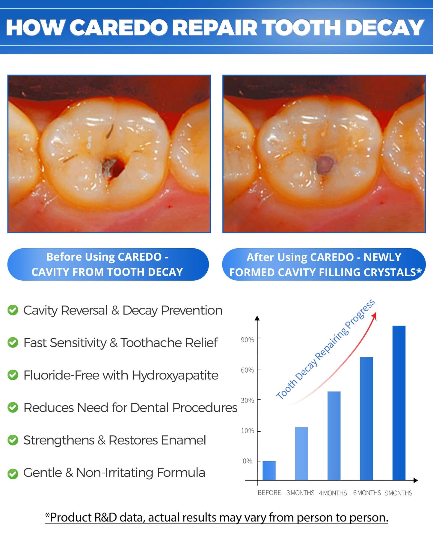 CAREDO Cavity Reversal Toothpaste - Fluoride-Free Hydroxyapatite Remineralizing 3.52 oz