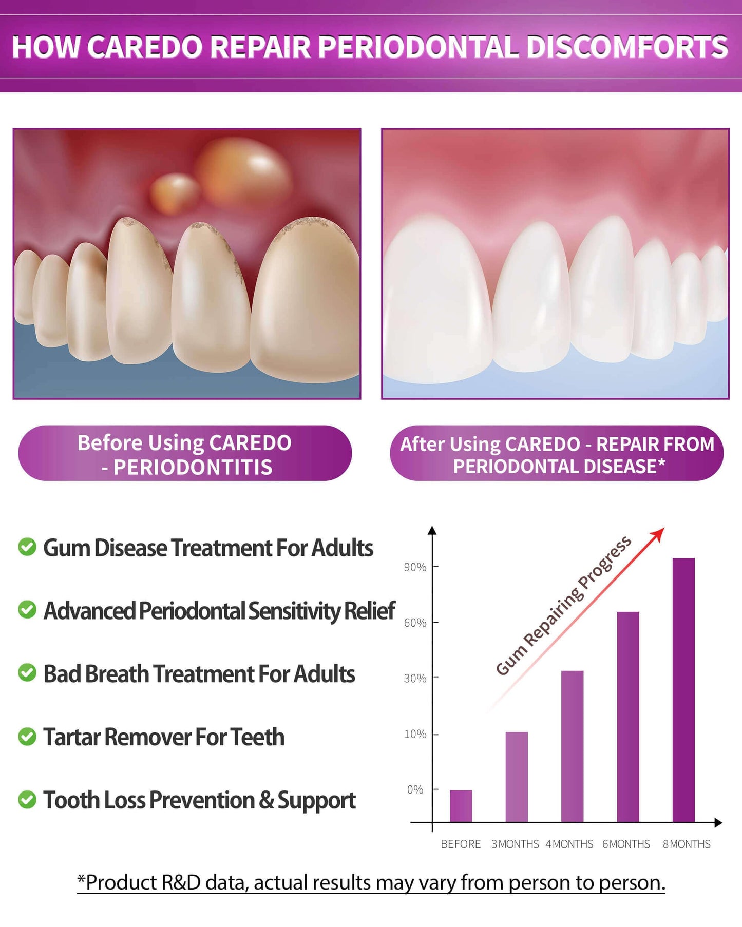 CAREDO Gum Repair Toothpaste - Fluoride Free Periodontal Treatment