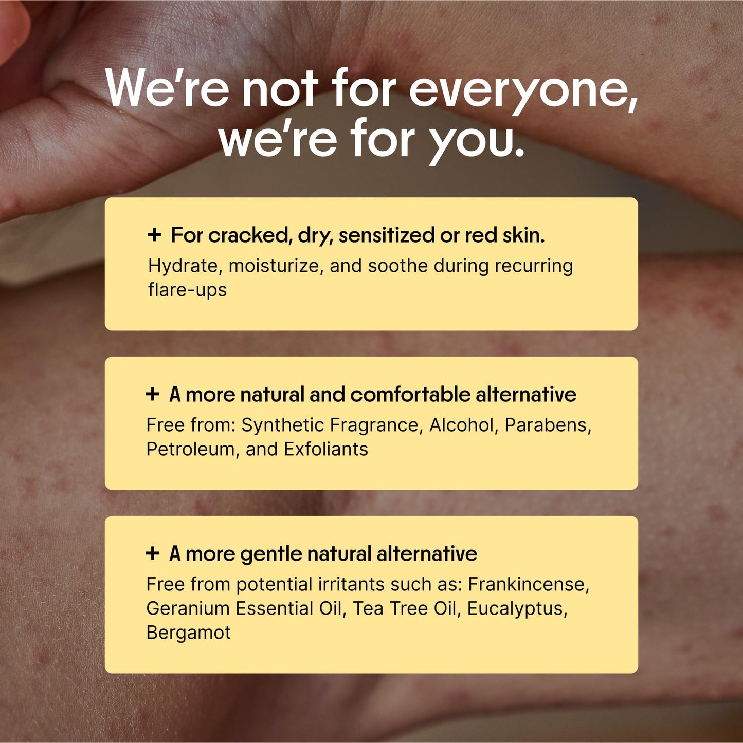 Clearbody Organics Manuka Honey Cream for Eczema & Dry Skin - Colloidal Oatmeal & Aloe - No Greasy Residue - 1 oz