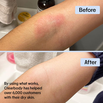 Clearbody Organics Oatmeal Lotion – Manuka Honey Eczema Cream & Hydration, 4 oz