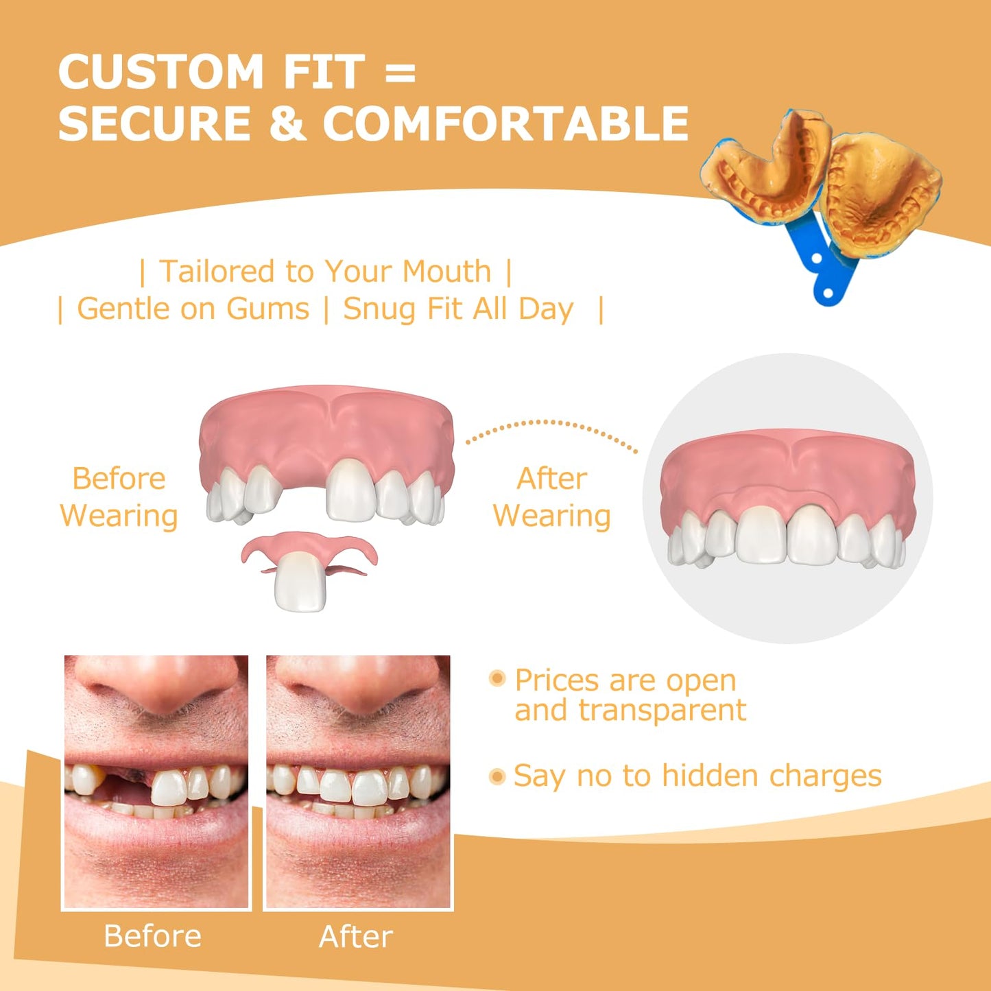 Partial Dentures (2 Teeth) – Lightweight, Durable Replacement Teeth for Missing Teeth