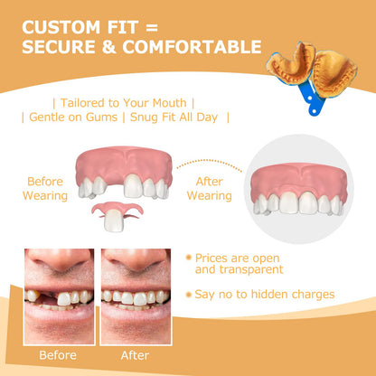 Partial Dentures (2 Teeth) – Lightweight, Durable Replacement Teeth for Missing Teeth
