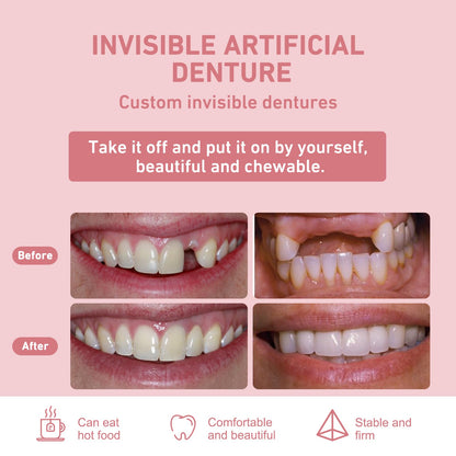 Custom Partial Dentures – Personalized Removable Denture Set for Missing Teeth | 1–6 Tooth Replacement with Storage Case | Natural Look & Comfortable Fit (1 Tooth)