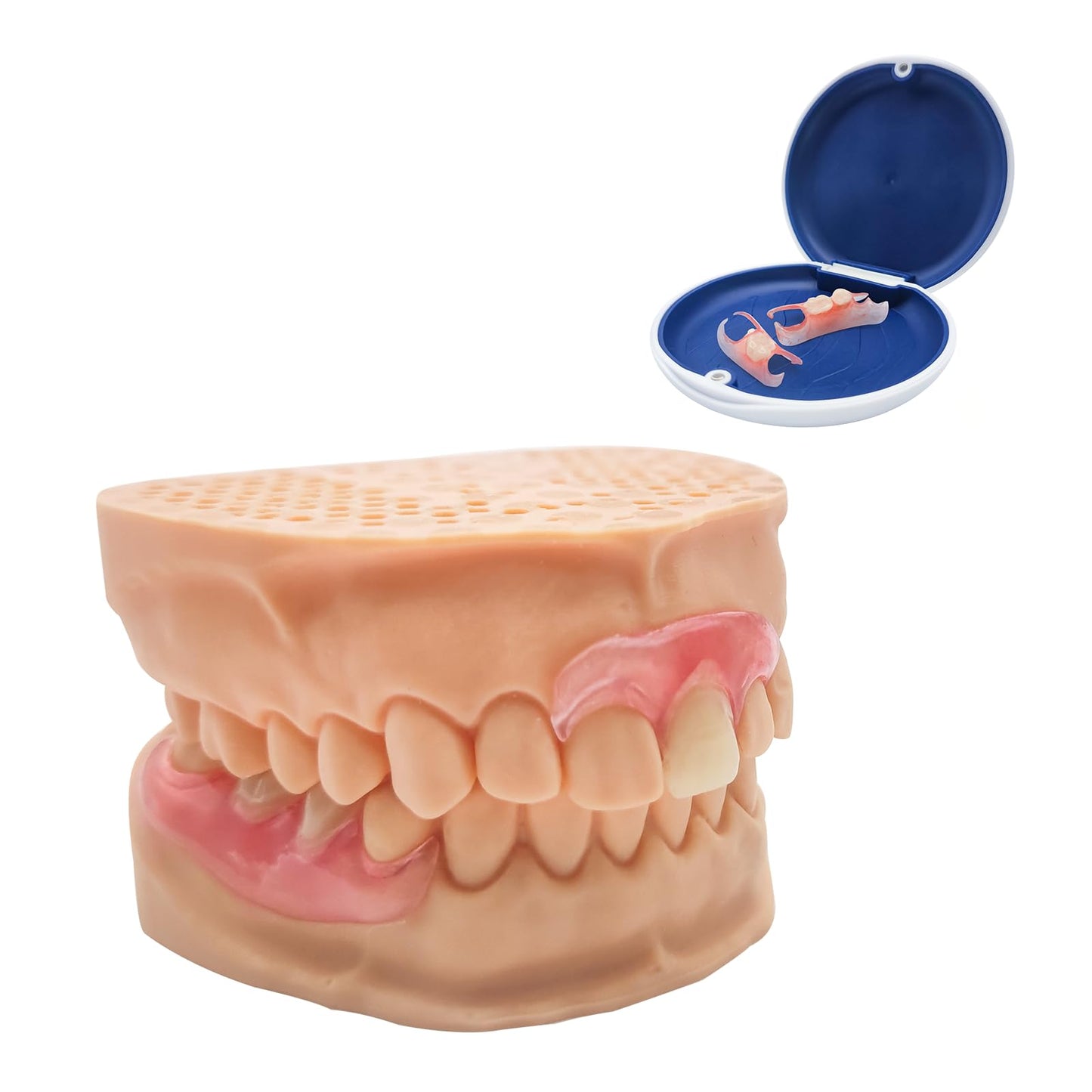 Custom Partial Dentures – Personalized Removable Denture Set for Missing Teeth | 1–6 Tooth Replacement with Storage Case | Natural Look & Comfortable Fit
