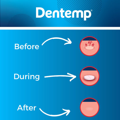 Dentemp Canker Cover - Canker Sore Medicine Pain Reliever (3pack) - Canker Sore Treatment to Relieve Canker Pain, Mouth Sores & Mouth Irritation - Fast Acting Canker Sore Relief Tablets for Adults