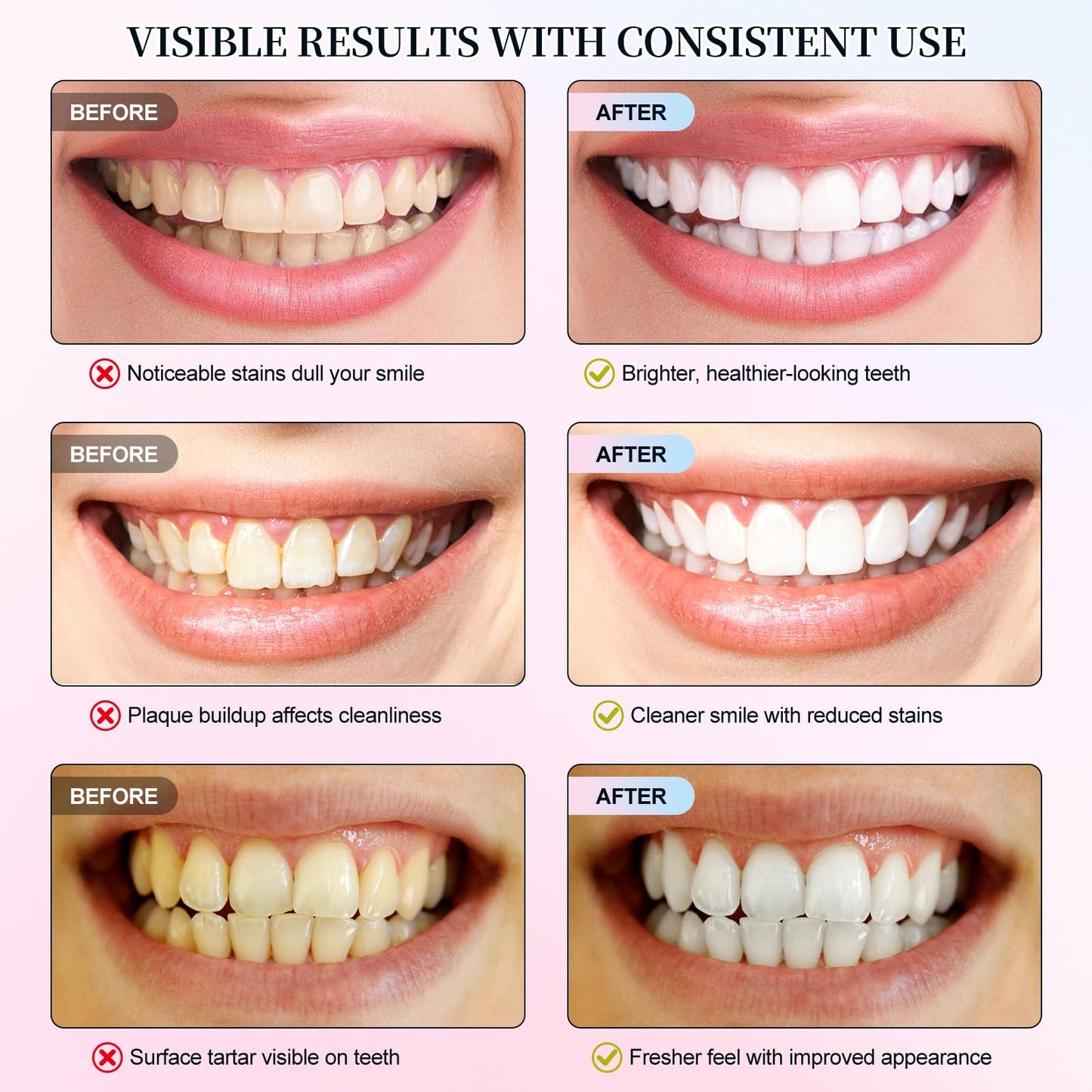 Niacinamide Whitening Toothpaste – Enamel Repair, Stain Removal (2 PCS)