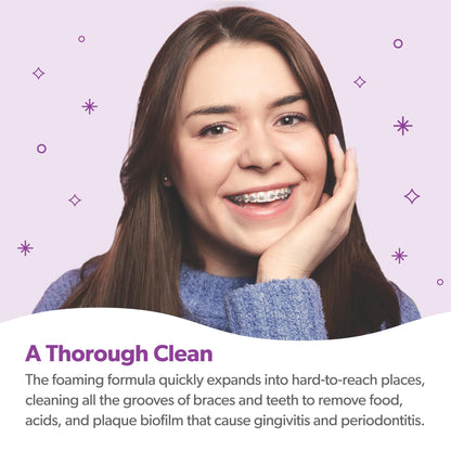 EverSmile OrthoFoam Braces Cleaner – Brushable Foam (50ml, 4 Pack)