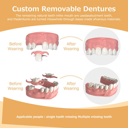 Partial Dentures (2 Teeth) – Lightweight, Durable Replacement Teeth for Missing Teeth