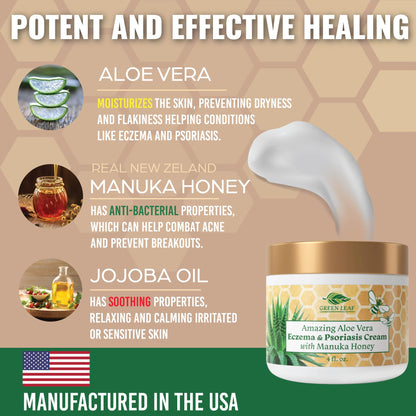 Manuka Honey Eczema Cream Moisturizing Lotion Treatment for Psoriasis Relief - Itchy, Dry Skin Rash Ointment - Soothing Moisturizer for Baby, Kids, Adults - High Strength Body & Face Cream 2oz