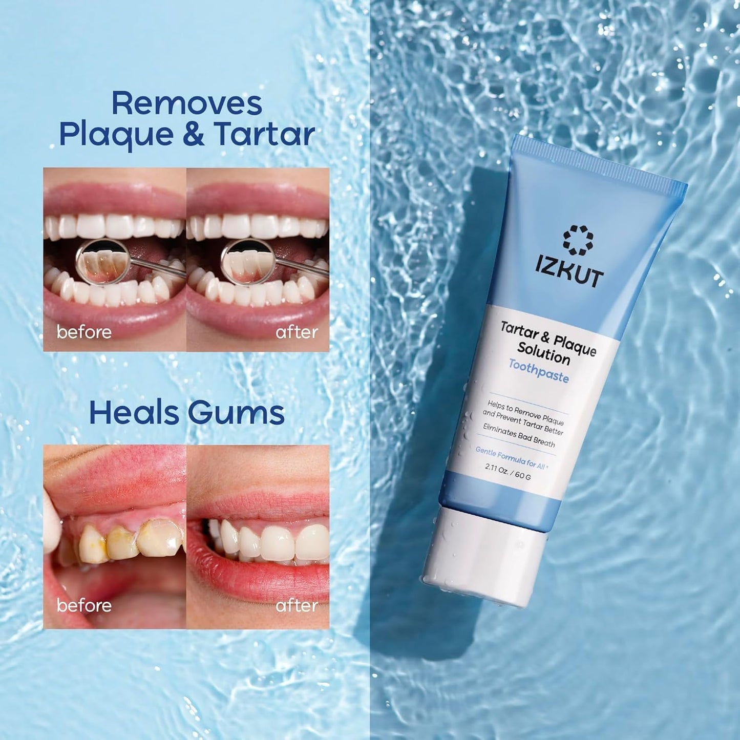 Plaque & Tartar Remover Toothpaste - Deep Clean, Tartar Control, Mint - 2 Pack