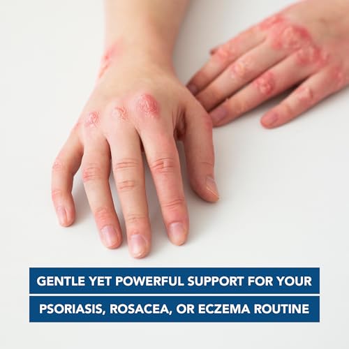 Kenkoderm Psoriasis Cream – 2% Salicylic Acid Fragrance-Free Moisturizer (10 oz) Pack of 4
