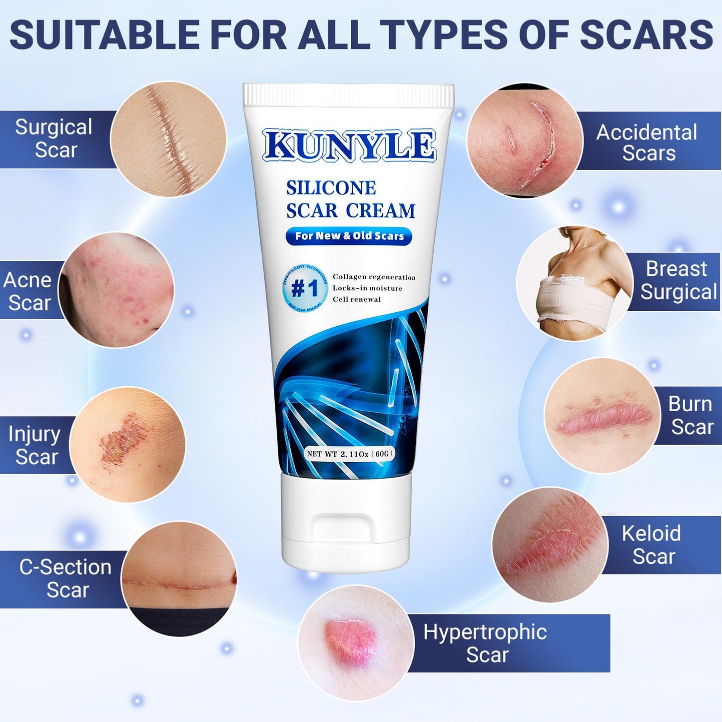 Kunyle Scar Cream – Silicone Scar Gel for Surgical Scars, Stretch Marks & Keloids (2.11 oz / 60 g)