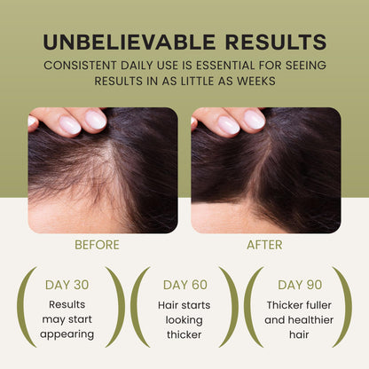 Lebanta Batana Oil for Hair Growth – 100% Pure, Organic Blend with Castor, Pumpkin Seed, Coconut & Rosemary (1 Pack)