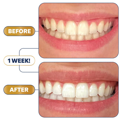Lumineux 2-in-1 Whitening Pen (1 Pack) – Enamel Safe, Clinically Proven Whitening