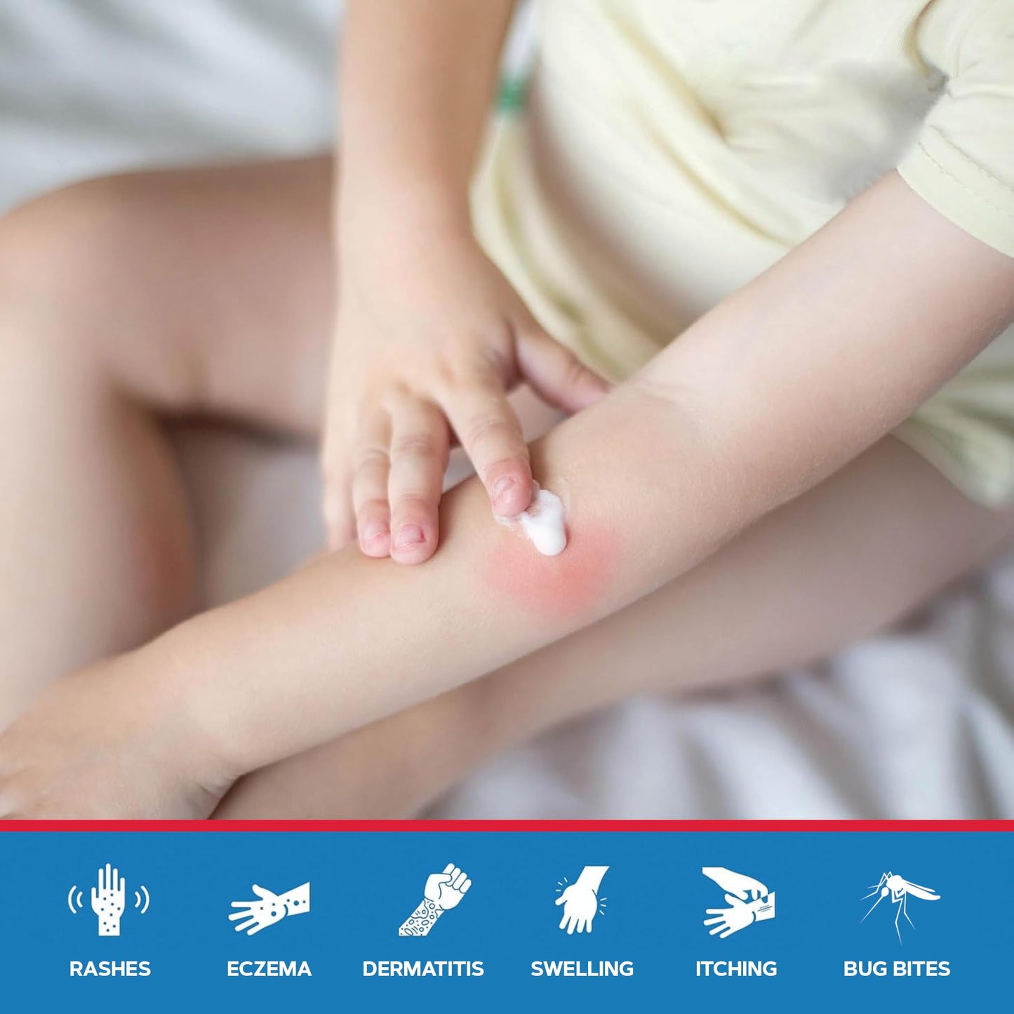 MED PRIDE Hydro Cortisone Cream 1% OTC — Bulk Pack 4x1oz for Rash, Eczema & Bug Bites