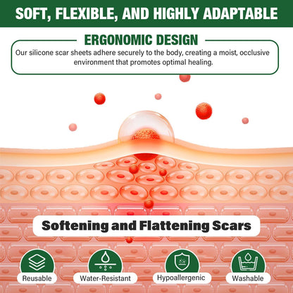 Mitreal Silicone Scar Sheets – 1.6x120 Roll | Surgical Scar Tape