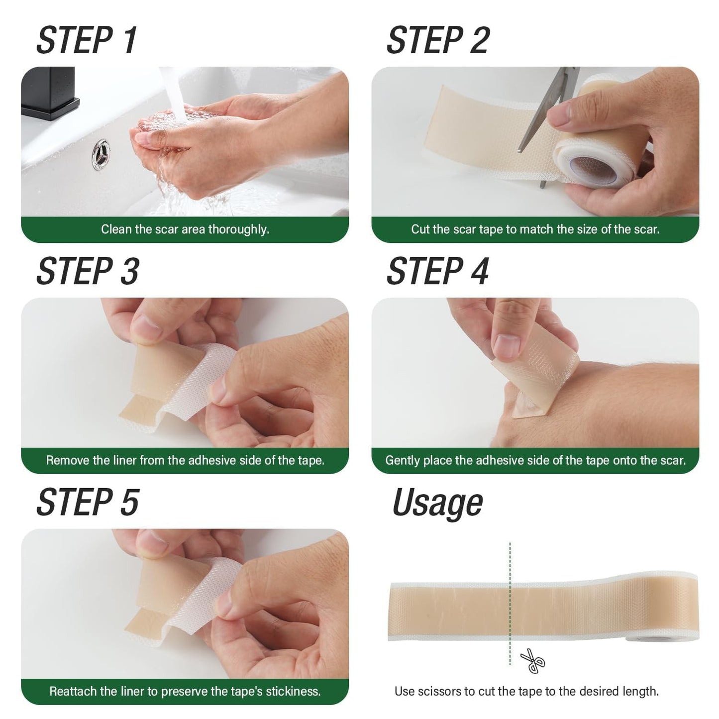Mitreal Silicone Scar Sheets – 1.6x120 Roll | Surgical Scar Tape