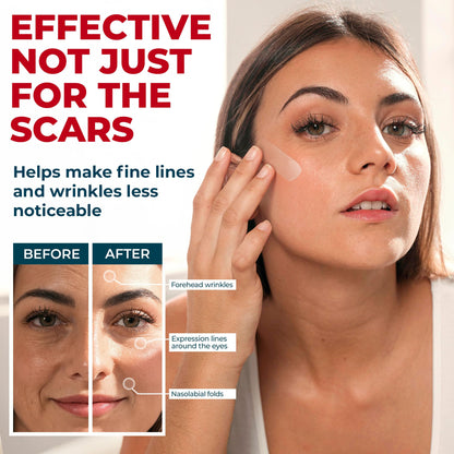 MYHELP Medical Grade Silicone Scar Tape – 1.6in x 120in | Visible Difference on Surgical & Keloid Scars