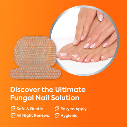 Natural Vine Fungal Nail Patches – Extra-Strength 1% Tolnaftate, Overnight Renewal (32 Patches x 2)
