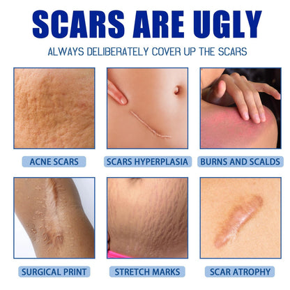 NYYQYYN Scar Cream • Silicone Gel for Surgical Scars & Keloids | All-Natural, Quick-Drying