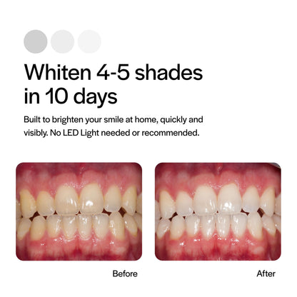 Opalescence Go 15 PF Prefilled Teeth Whitening Trays - 10 Treatments | Ultradent GO15-PF-4638