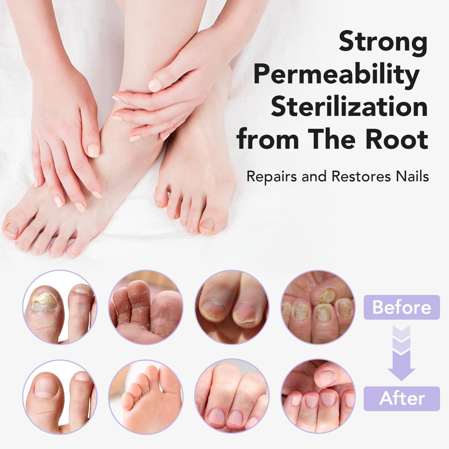 ourui one Toenail Fungus Treatment Extra Strength – Fast 4-Week Nail Care (30ml)