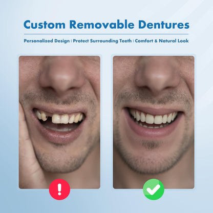 Custom Removable Dentures – Personalized Partial Denture Set for Tooth Replacement | 1–Multi-Tooth Coverage with Storage Case | Comfortable Wear for teeth (5 Teeth)