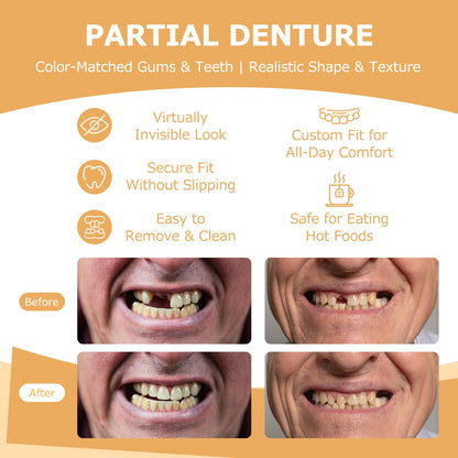 Partial Dentures - Lightweight, Unbreakable Replacement Teeth (5 Teeth) for Missing Teeth | Men & Women