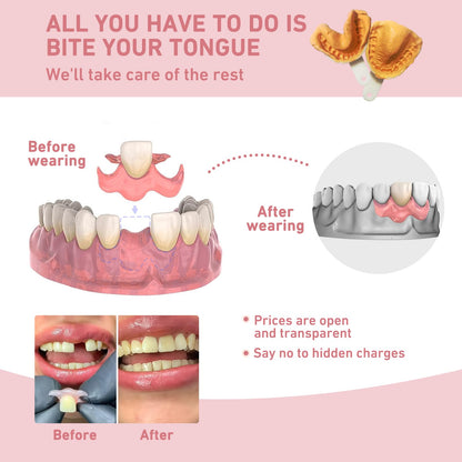Custom Partial Dentures – Personalized Removable Denture Set for Missing Teeth | 1–6 Tooth Replacement with Storage Case | Natural Look & Comfortable Fit (5 Teeth)