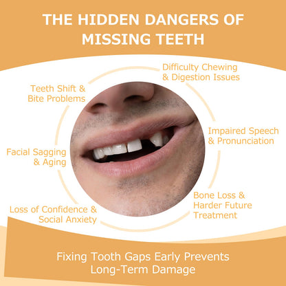 Partial Dentures - Lightweight, Unbreakable Replacement Teeth (5 Teeth) for Missing Teeth | Men & Women