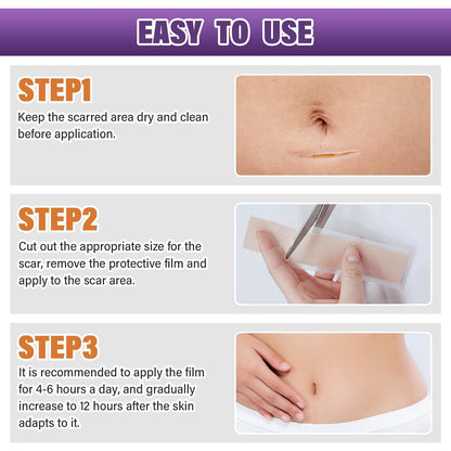 Psecici Silicone Scar Sheets & Tape – Medical-Grade, Reusable Scar Strips (1.6 x 59 in Roll)