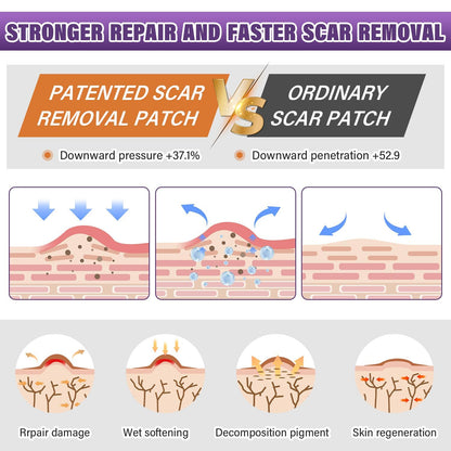 Psecici Silicone Scar Sheets Roll 1.6x120 – Medical-Grade Scar Tape for Surgical, C-Section, and Keloids