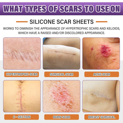 Psecici Silicone Scar Sheets Roll 1.6x120 – Medical-Grade Scar Tape for Surgical, C-Section, and Keloids