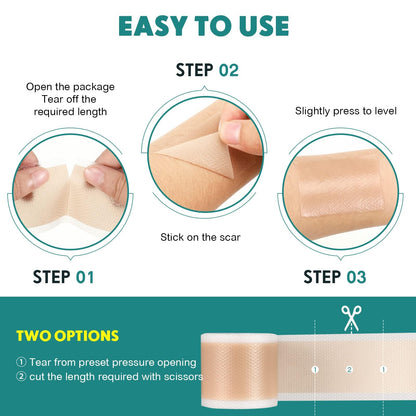 Pumkot Silicone Scar Sheets & Tape Roll – 1.8 x 157 inch for Surgical, C-Section, Burns
