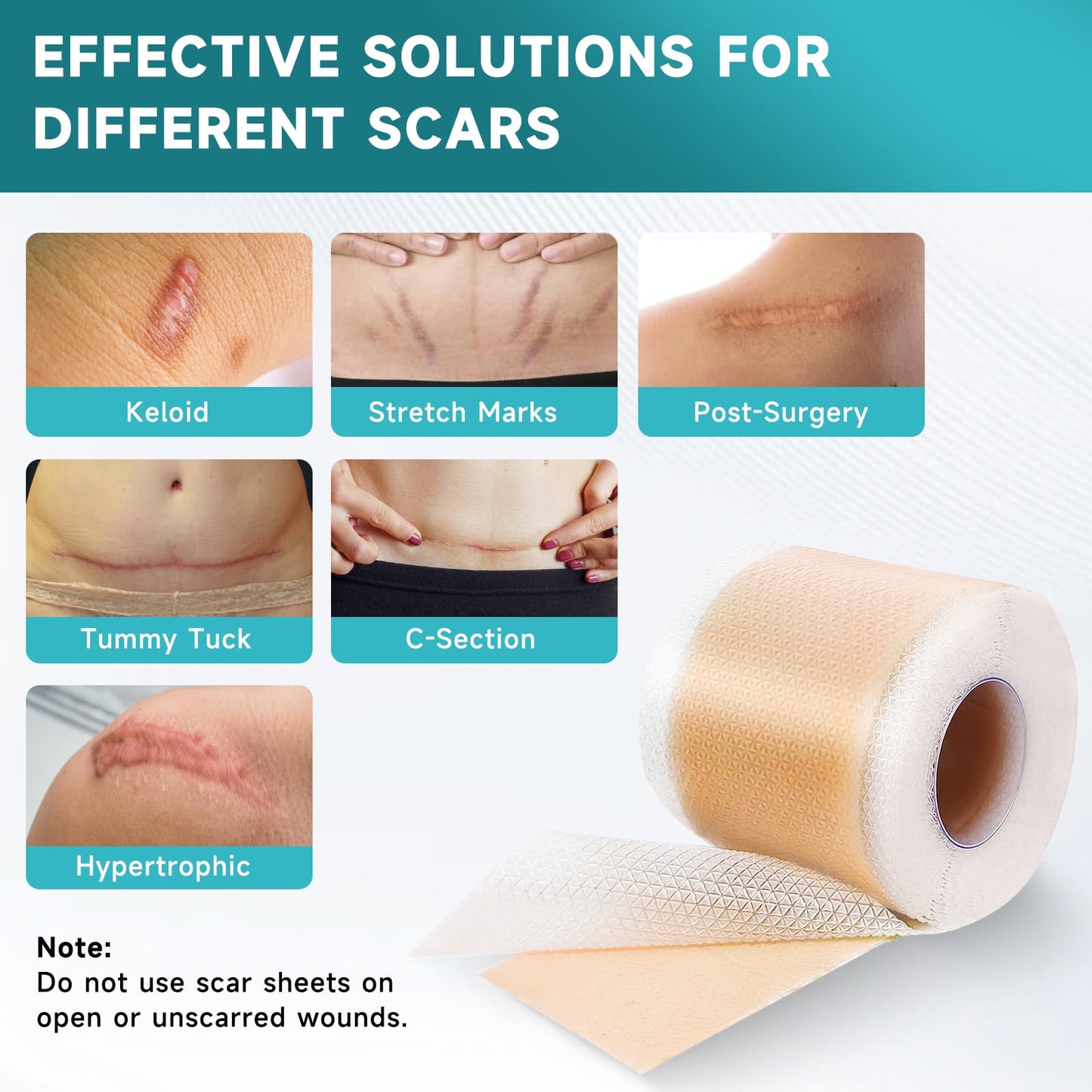 Pumkot Silicone Scar Sheets & Tape – 1.6”x60” Roll for Surgical Scars, C-Section & Burns