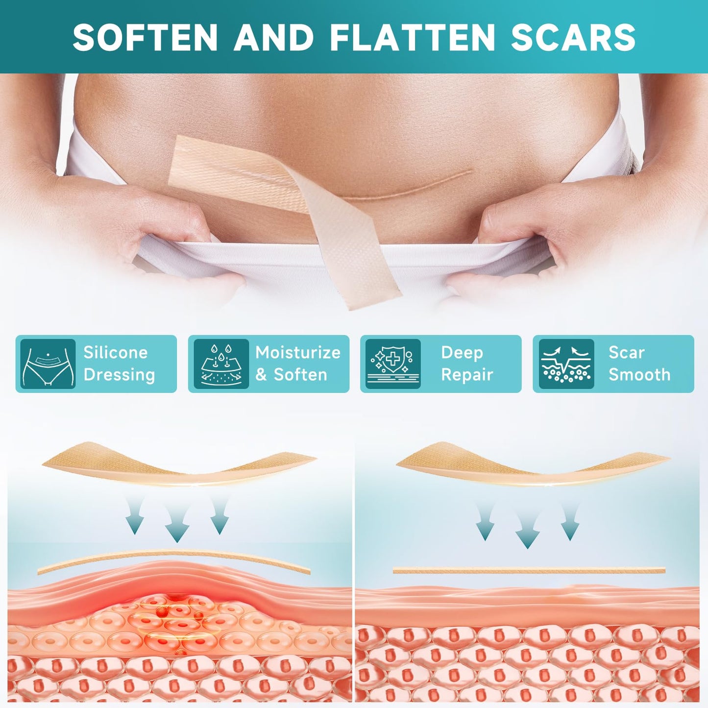 Pumkot Silicone Scar Sheets & Tape Roll – 1.8 x 157 inch for Surgical, C-Section, Burns