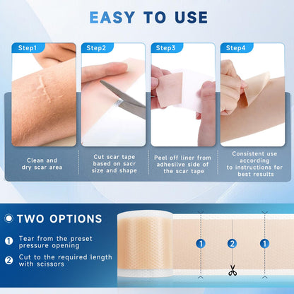 Rvlaim Silicone Scar Sheets – 1.8” x 157” Roll for Surgical Scars, Keloids, Stretch Marks