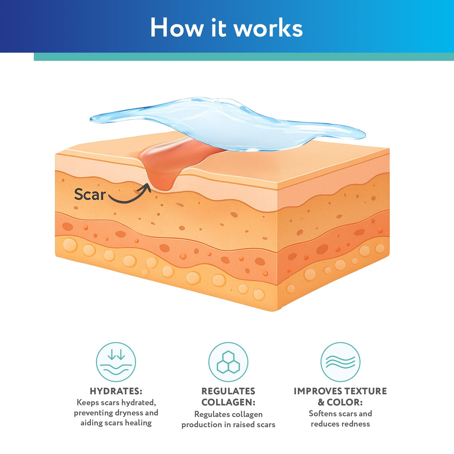 ScarAway Silicone Scar Gel - Improve Scar Size, Color & Texture | Water-Resistant 20g