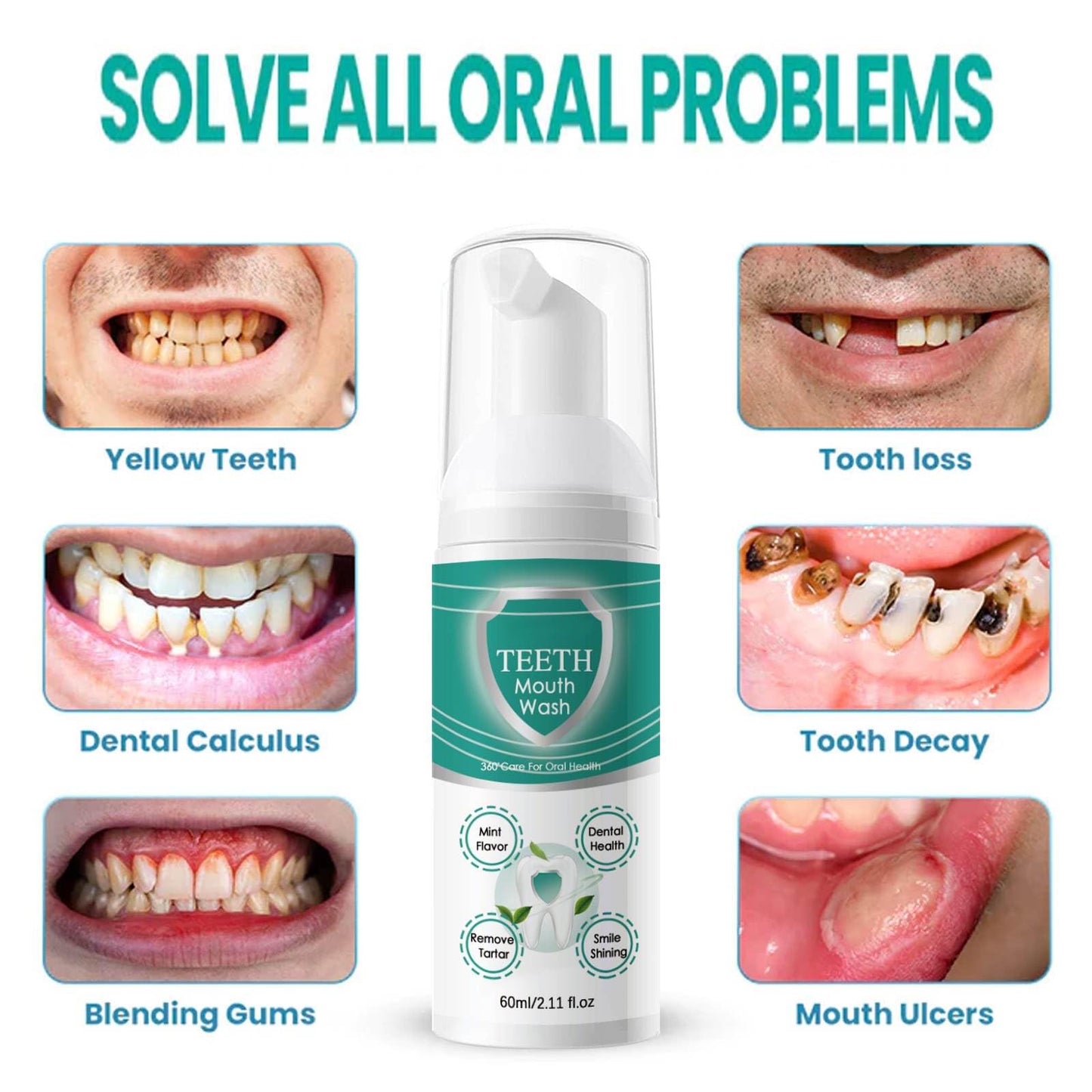 Sheghy Teeth Total Care Mouthwash & Mint Toothpaste Set - 2pc