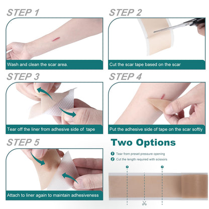 SLUKHIG Silicone Scar Sheets Roll 4M - Reusable Scar Tape for C-Section, Burns, Acne
