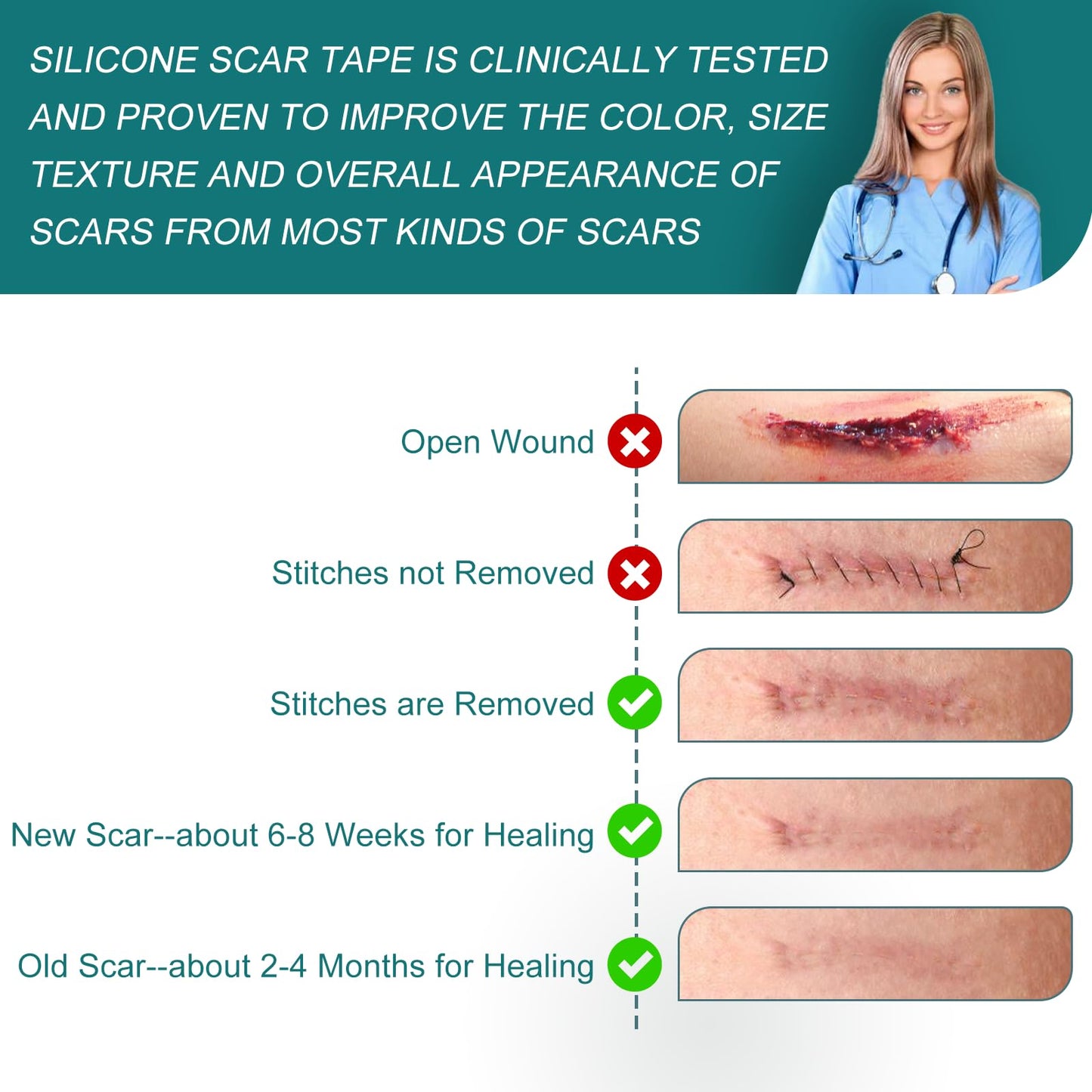 SLUKHIG Silicone Scar Sheets Roll 4M - Reusable Scar Tape for C-Section, Burns, Acne